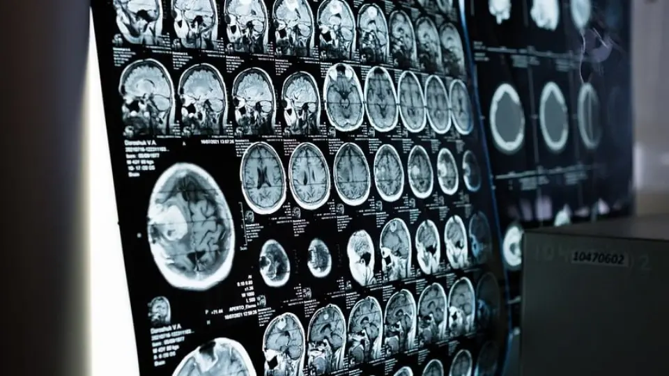 Neurocientista disseca as virtudes e complexidades do cérebro humano